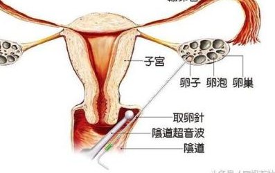2026年！泰国第三代试管医院费用全揭秘，赶紧收藏起来备用吧！