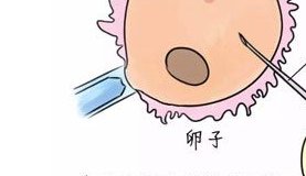 泰国试管婴儿移植后吃什么更容易着床