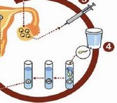 潮州市生孩子做染色体检查有必要吗，筛查一次大概需要多少钱？
