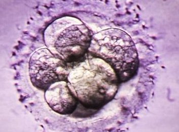 阿勒泰青河县在哪做试管婴儿，阿勒泰地区青河县医院